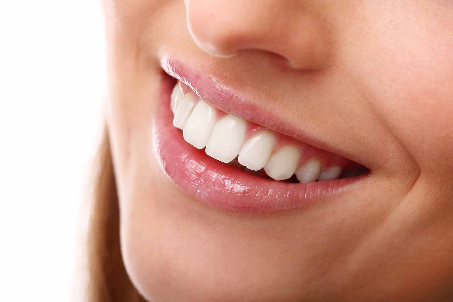 beautiful-smile-perfect-teeth-1500-x-1000